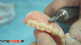 دانلود استوک فوتیج دندان پزشکی : تراش لسه Dentures
