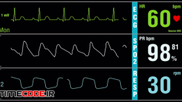 دانلود فوتیج مانیتور قلب Patient Monitor With Vital Signs