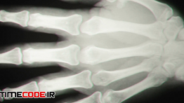 دانلود استوک فوتیج : اسکن بدن Background Of X-Ray