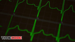 دانلود فوتیج مانیتور ضربان قلب Cardiogram Medical Video Background